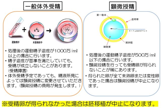 受精方法